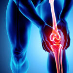Knee painful – skeleton x-ray, 3D Illustration medical concept.